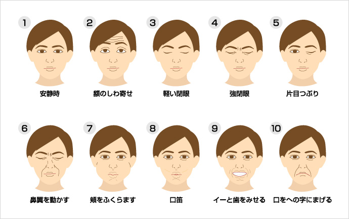 顔面神経麻痺検査柳原法