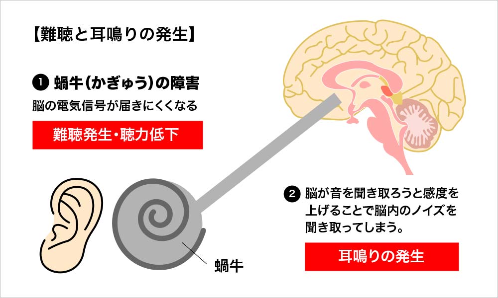 難聴と耳鳴りの発生