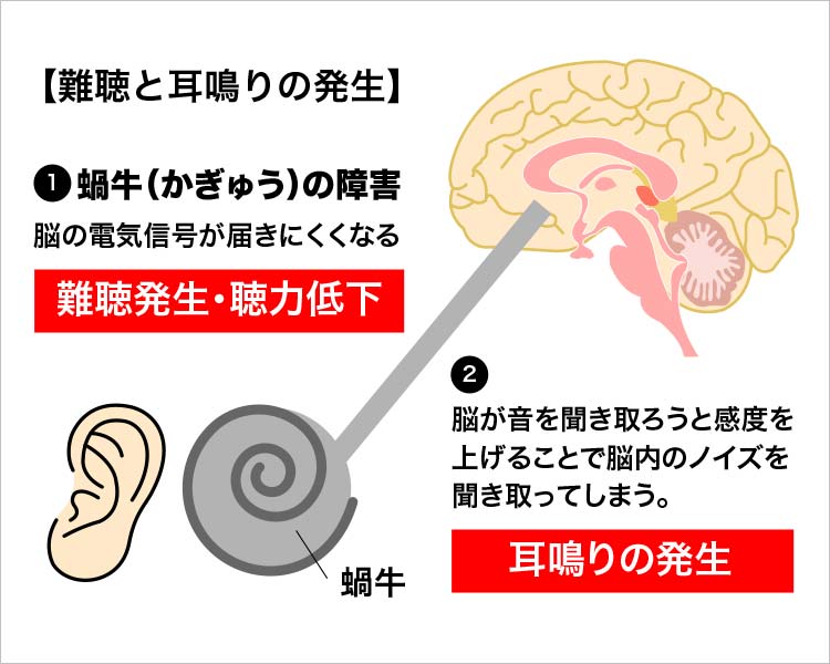 難聴と耳鳴りの発生