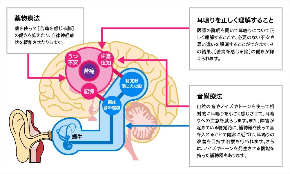 難聴と耳鳴りの発生