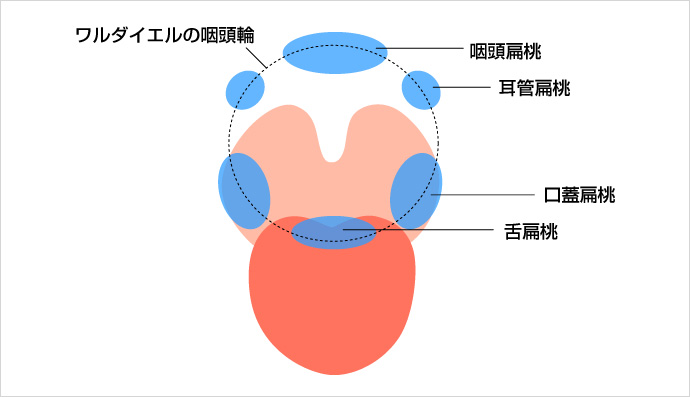 急性扁桃炎