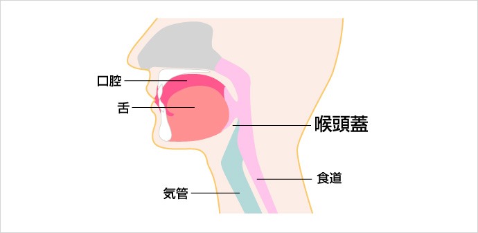 急性喉頭蓋炎