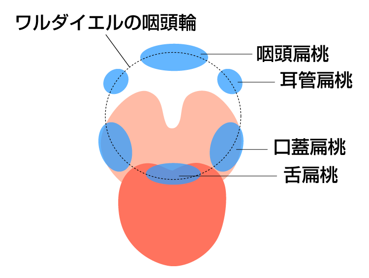 急性扁桃炎