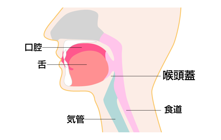 急性喉頭蓋炎